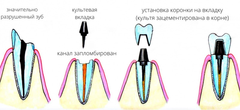 Культевая вкладка